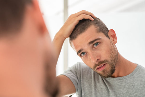 Hair Loss In Men